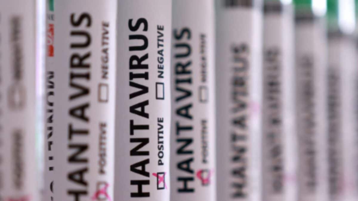 Exposures, Confirmed Cases And Deaths: What Numbers Reveal About Hantavirus Outbreak On Cruise Ship