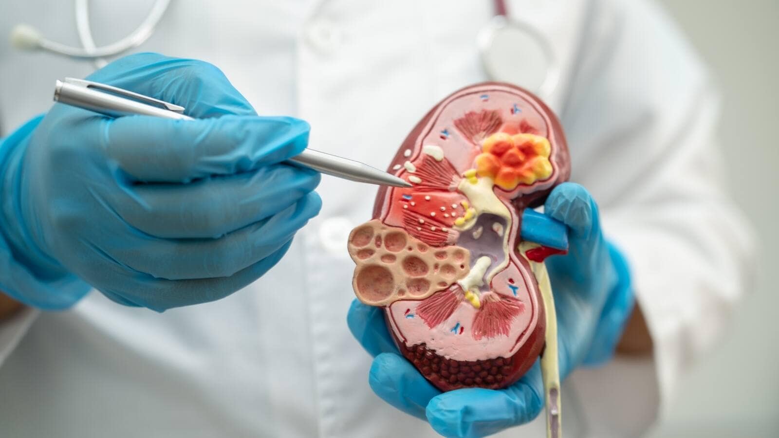 Diabetic Patients Avoid These Dietary Mistakes Or Your Kidney Could Be Damaged Continuously Diabetic Patients Avoid These Dietary Mistakes Or Your Kidney Could Be Damaged Continuously
