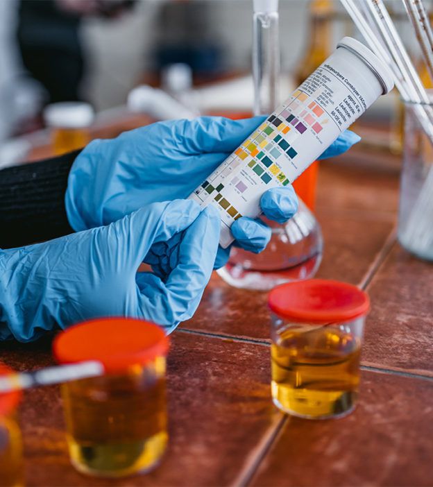 8. Stored Urine TestWhat you need: A clean glass jar and first-morning urine. How it works: Store the sample undisturbed for 24 hours. Traditional belief: The appearance of a thin film or layer on top is thought to suggest pregnancy.