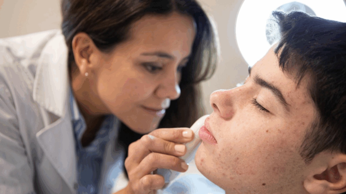 How To Prevent Acne During Monsoon: A Dermatologist's Guide To Clear Skin