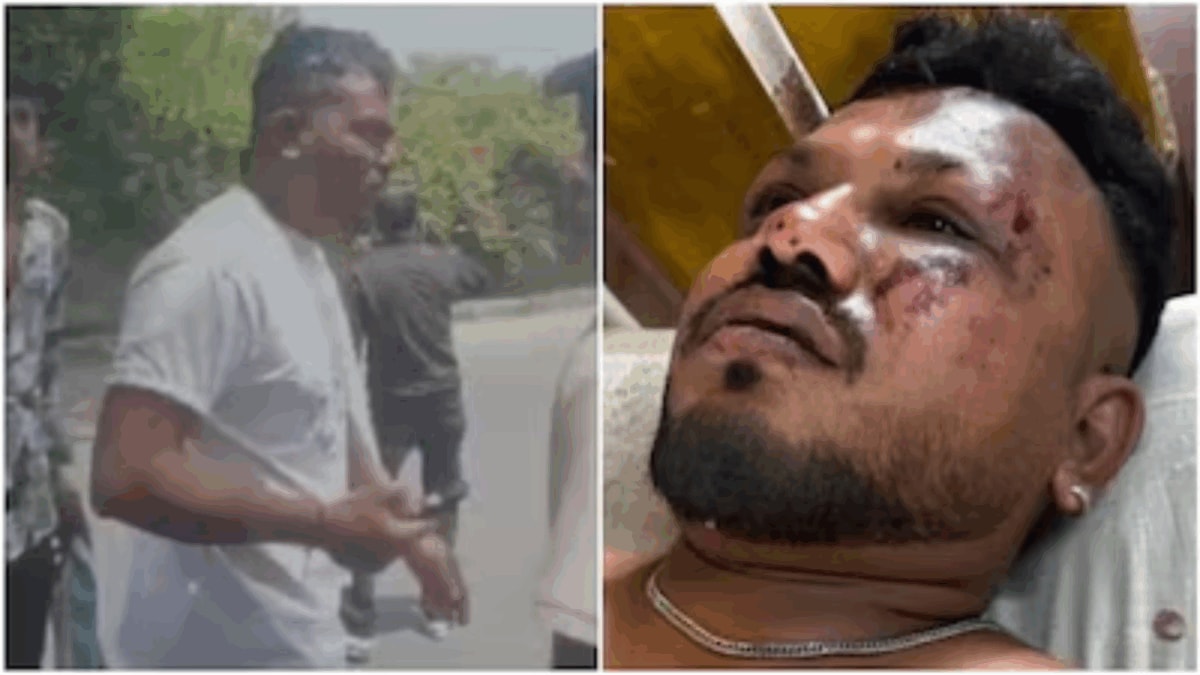 ‘Challenges Continue Behind Closed Doors’: Air India Plane Crash’s Lone Survivor Still Coping With Trauma