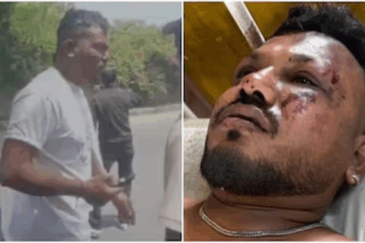 ‘Challenges Continue Behind Closed Doors’: Air India Plane Crash's Lone Survivor Still Coping With Trauma