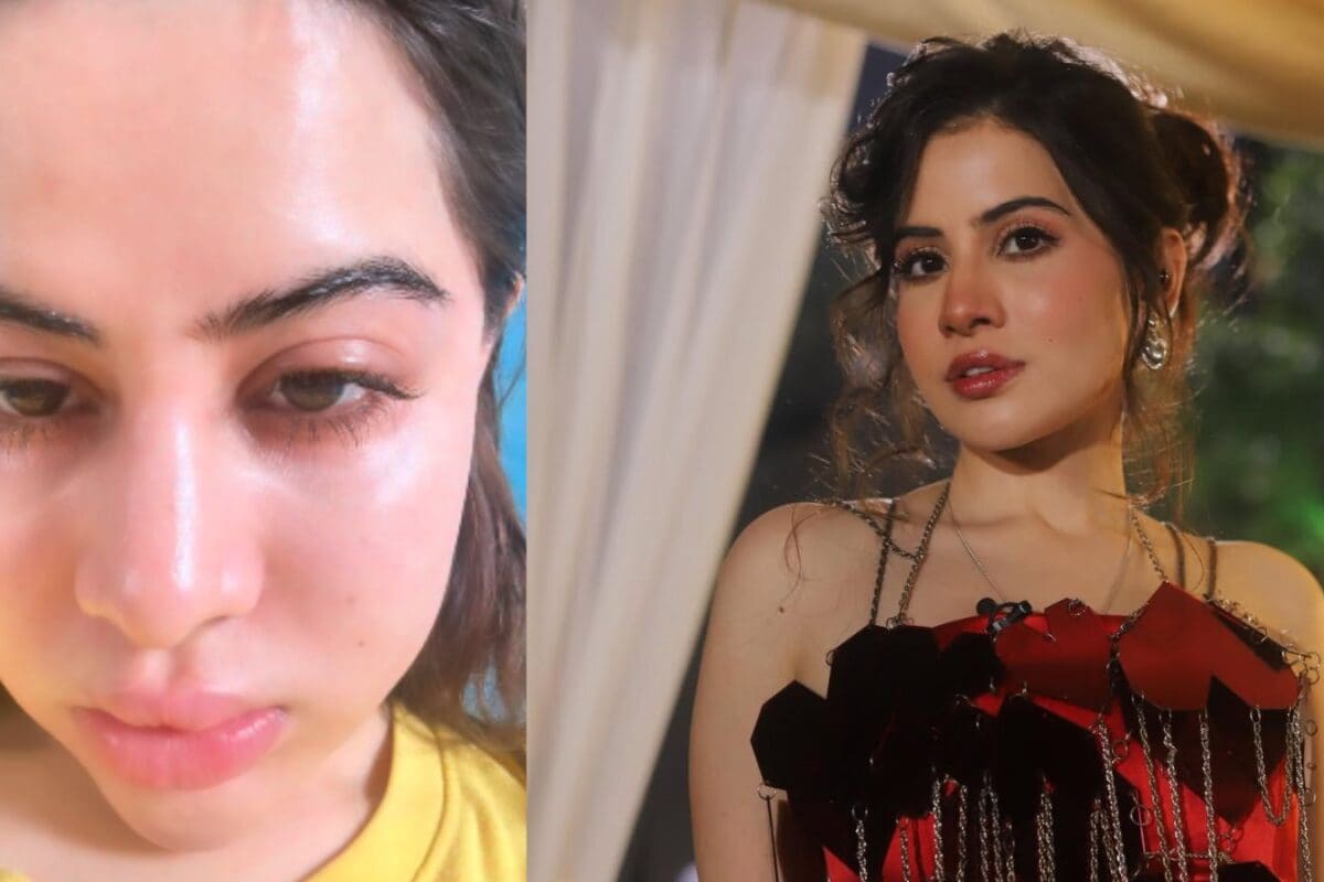 'Koi Filler Nahi Tha': Uorfi Javed Reveals What Caused Her Swollen Face Last Year
