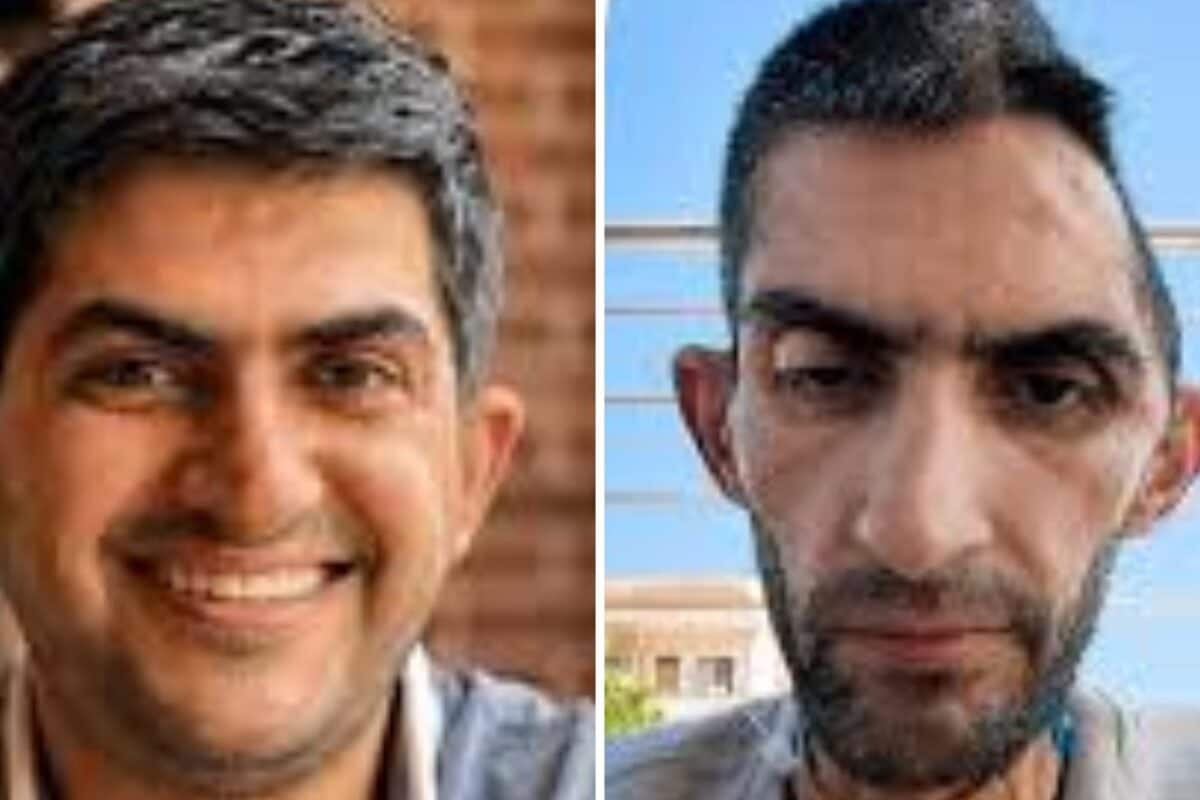 Part Of Skull Removed, Starved For Days: Why Images Of Palestinian Journalist Have Shocked The World