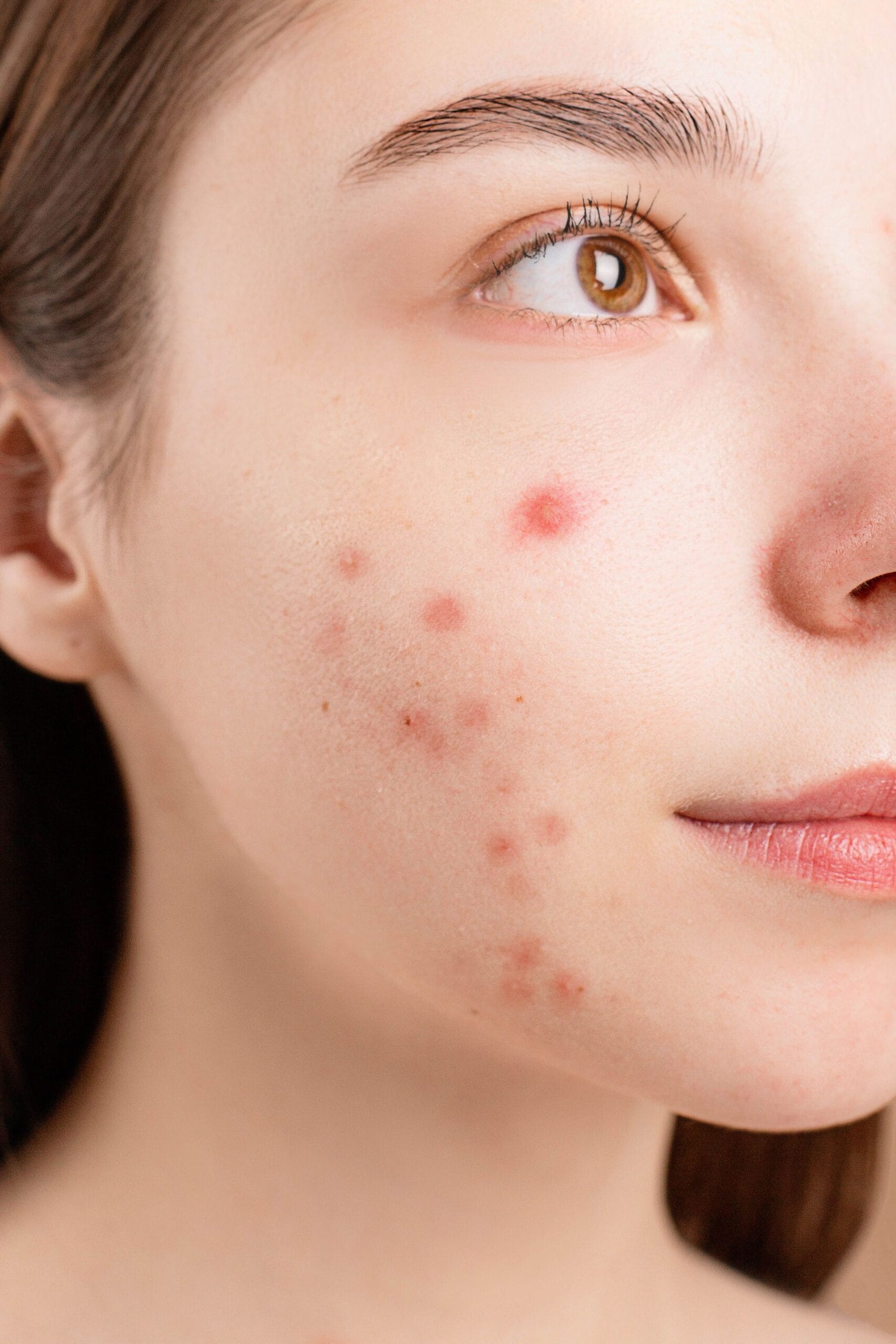 Skin Problems: Conditions such as acne, eczema, rosacea, or unexplained rashes have been linked to inflammation and imbalances in the gut, often referred to as the gut-skin connection. Skin Problems: Conditions such as acne, eczema, rosacea, or unexplained rashes have been linked to inflammation and imbalances in the gut, often referred to as the gut-skin connection.