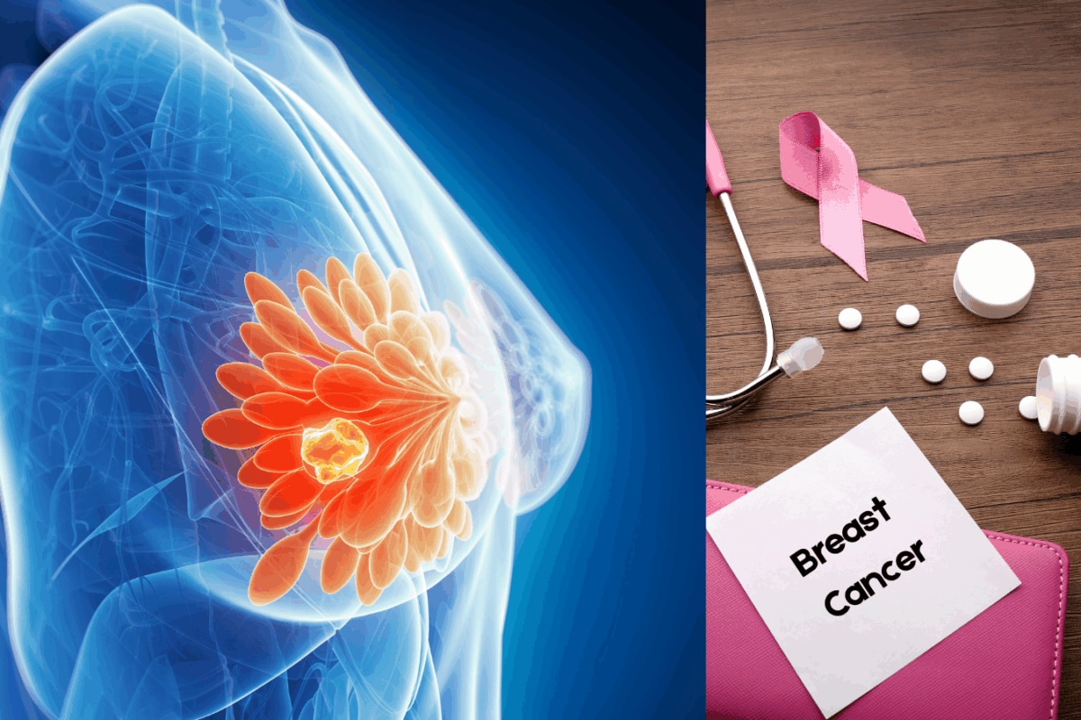 A Life-Saving Drug vs Judicial Red Tape: The Ribociclib Case That Is Putting Breast Cancer Patients At Risk| Explained