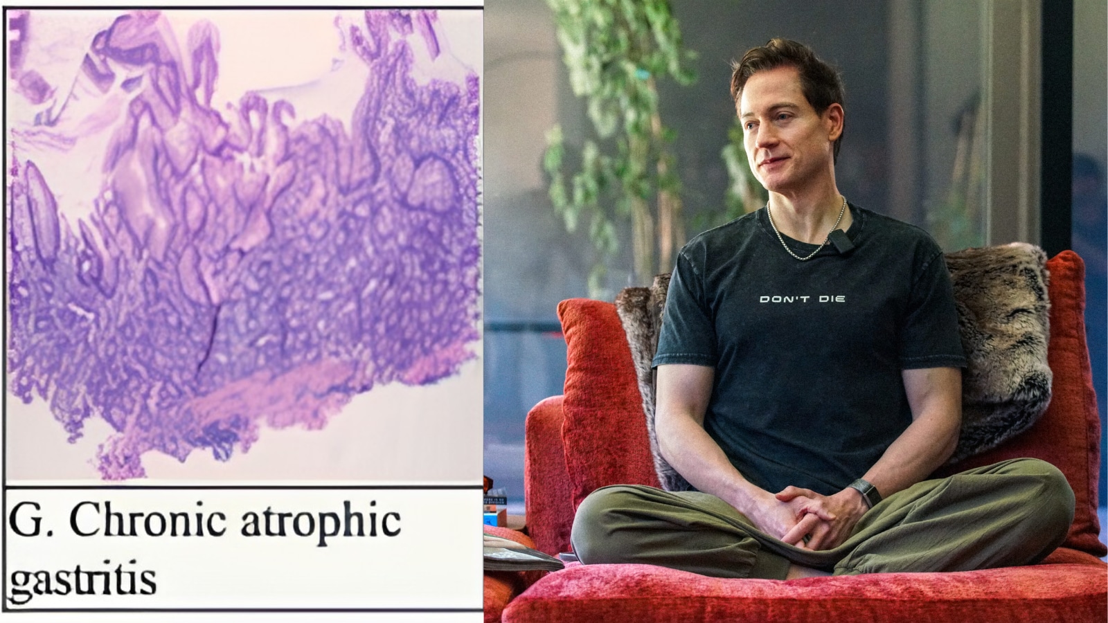 Bryan Johnson's Autoimmune Gastritis Diagnosis Is Raising Awareness About A Rare Digestive Disease