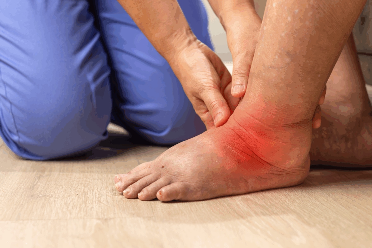 Is High Uric Acid Causing Your Swollen Hands And Feet? These 3 Foods Could Be Worsening Your Symptoms