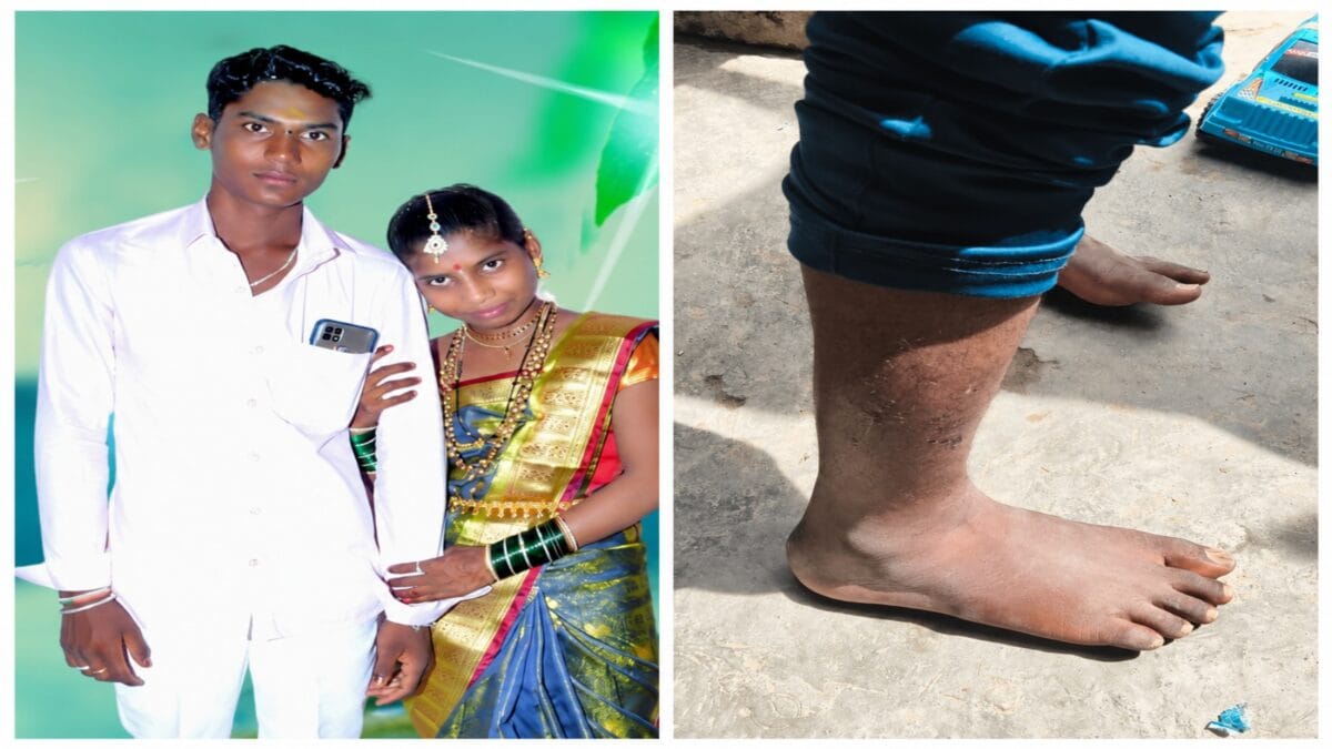 Stripped, Tied, Beaten: Bengaluru Baby Death Case Takes Twist As Family Claims Police Torture To Prove Murder