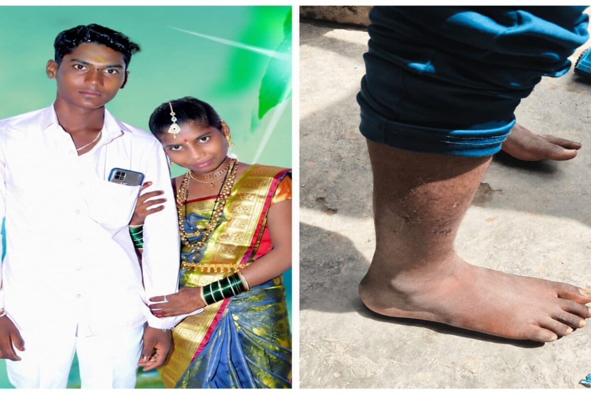 Stripped, Tied, Beaten: Bengaluru Baby Death Case Takes Twist As Family Claims Police Torture To Prove Murder