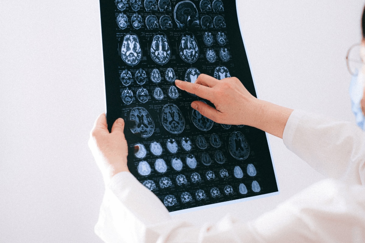 World Brain Day 2026: Everyday Mistakes That May Be Hurting Your Brain