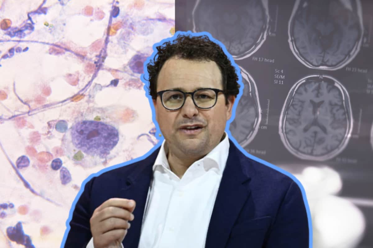AI Could Fast-Track Cancer And Alzheimer’s Treatments: Anthropic CEO Predicts A Medical Revolution Within 10 Years