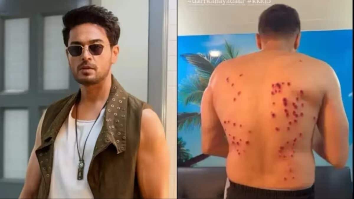 Khatron Ke Khiladi 15: Gaurav Khanna Injured During Stunt, Calls It His 'Most Painful Experience Ever'
