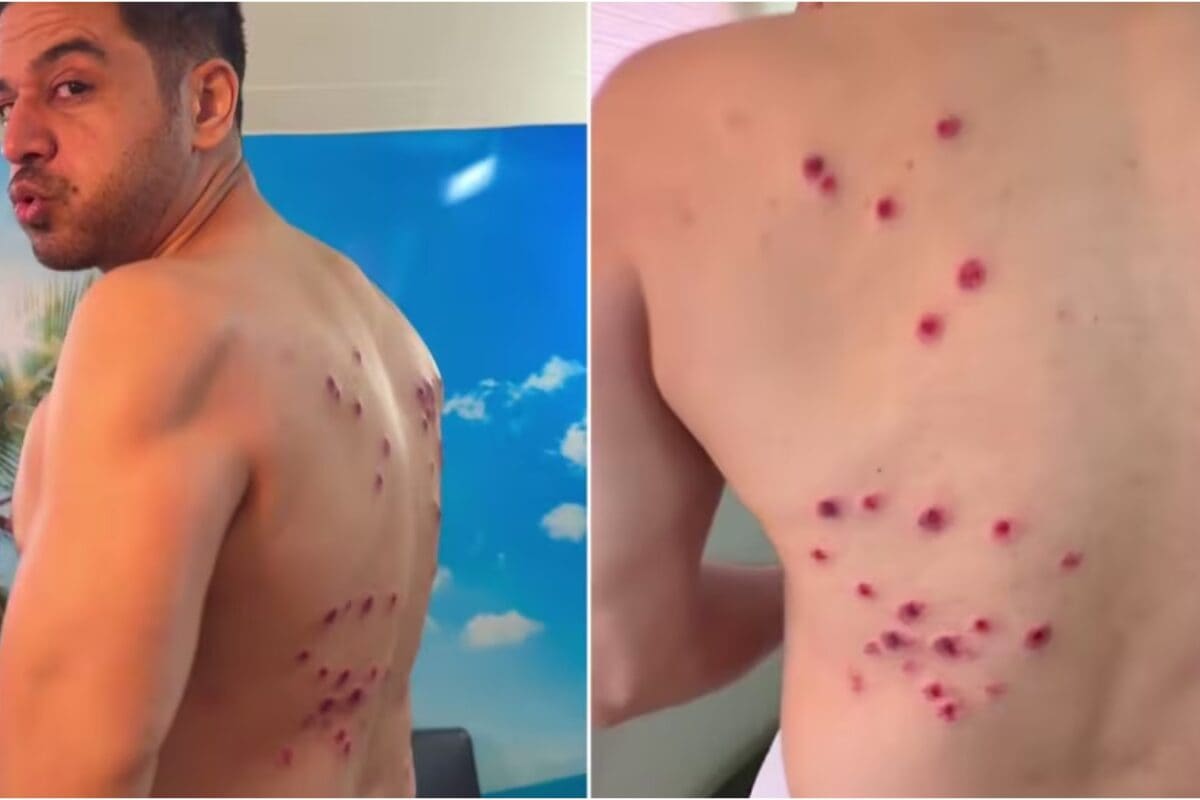 ‘Safety Procedures Are Followed’: Khatron Ke Khiladi Maker Reacts After Gaurav Khanna's Injuries Spark Outrage