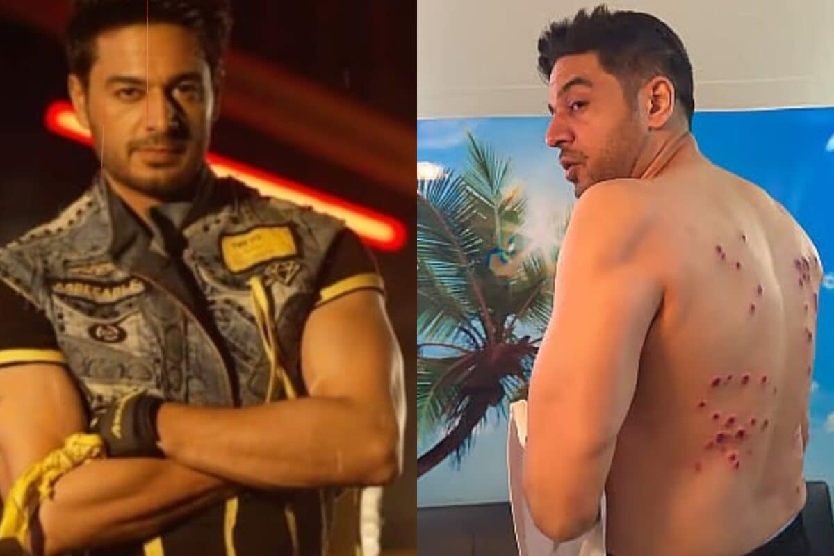 Khatron Ke Khiladi 15: Gaurav Khanna Shares Painful Injury Marks After Rubber Bullet Challenge