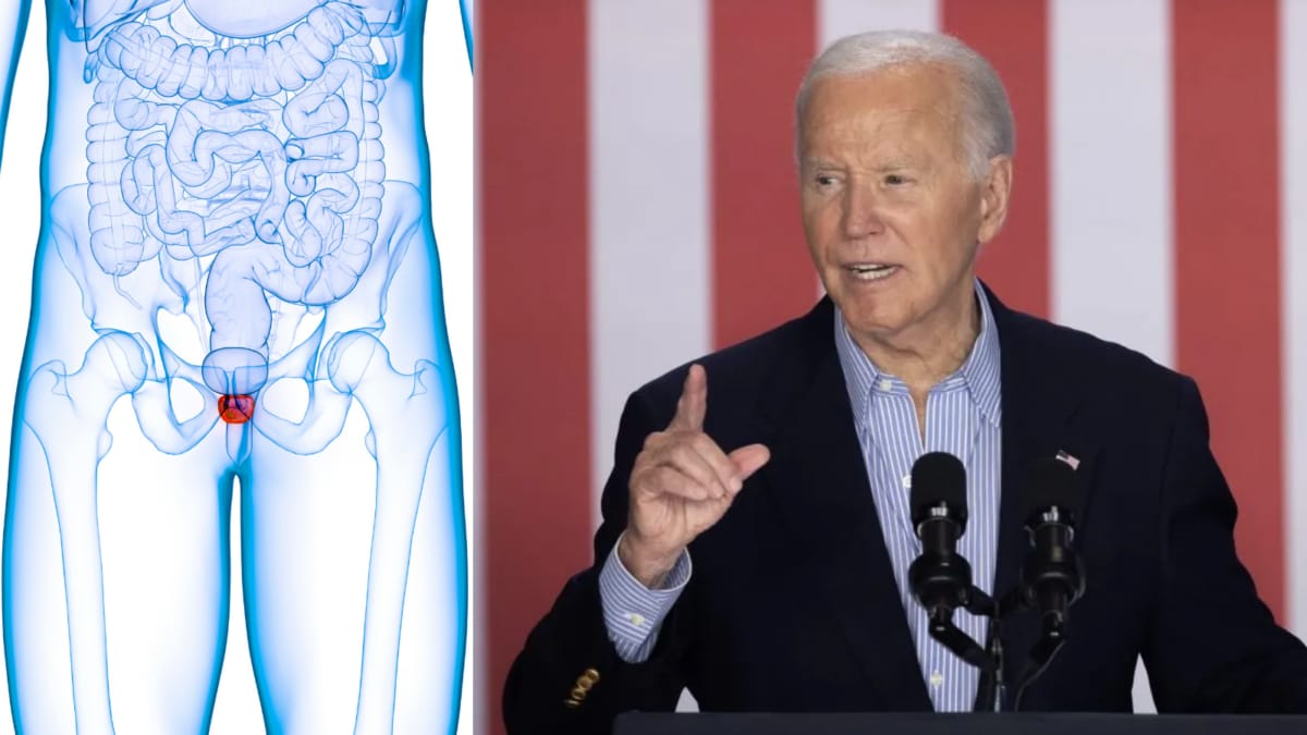 Joe Biden's Prostate Cancer Spreads To Bones: What Is Bone Metastasis And How Does It Affect The Body?