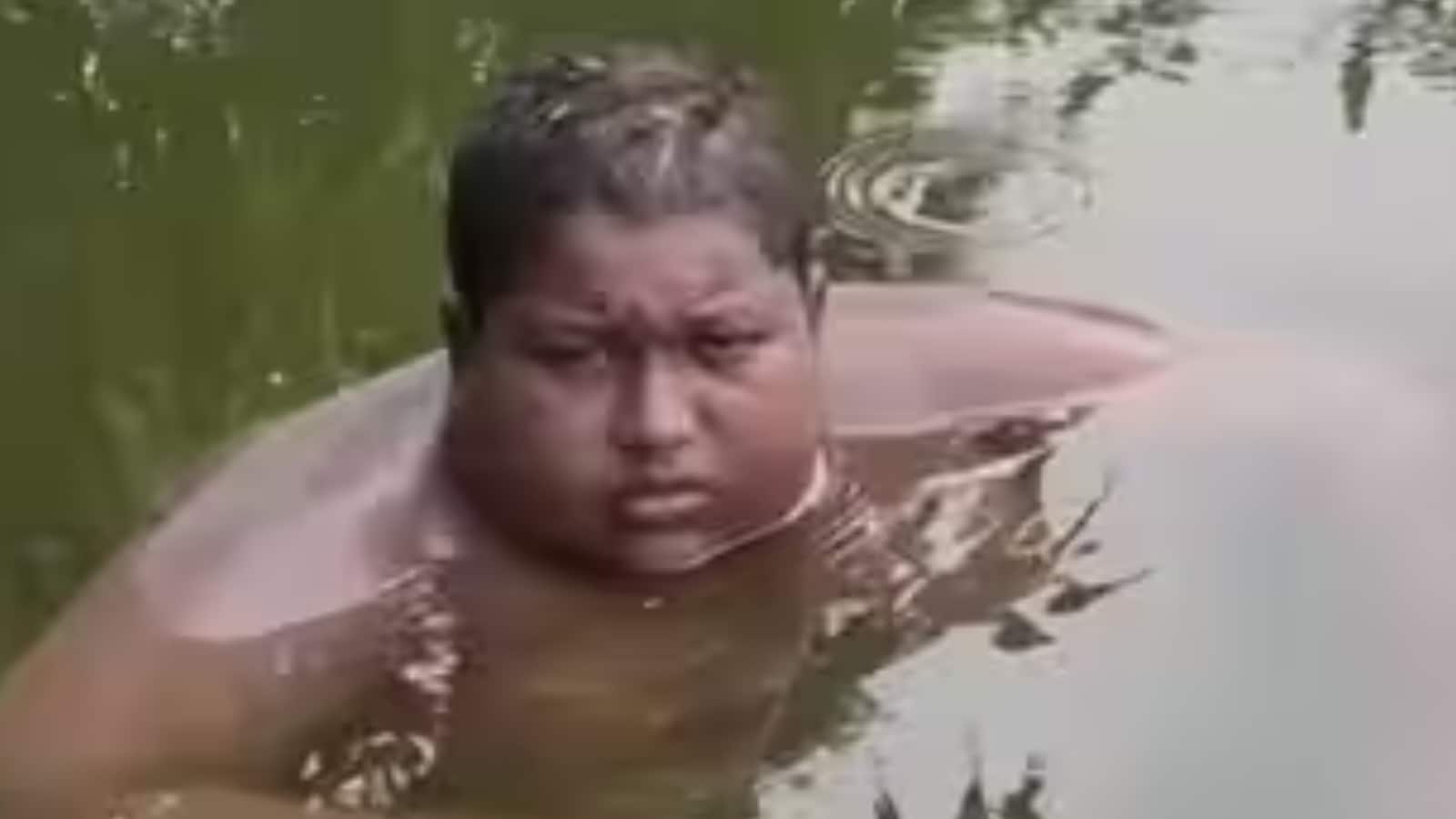 Bengal Boy, 16, Has Spent 5 Years Living In Water: ‘I’m Possessed And My Body Burns’