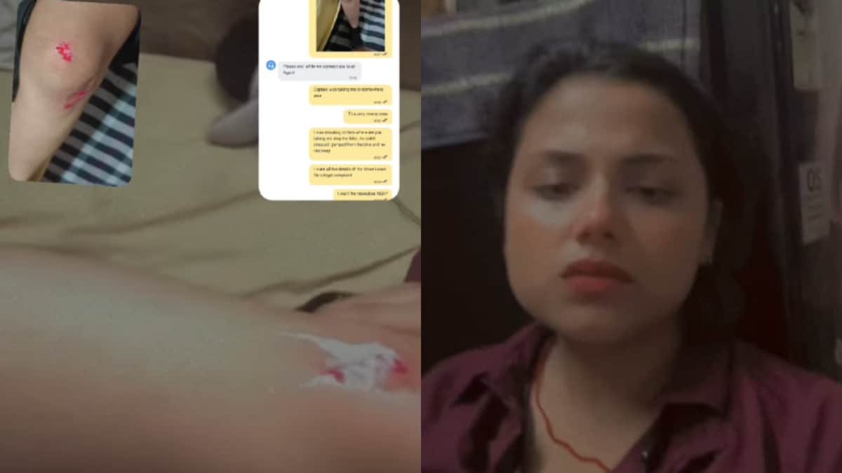 Delhi Woman Injured After Jumping From Moving Rapido Bike Over Safety Fears
