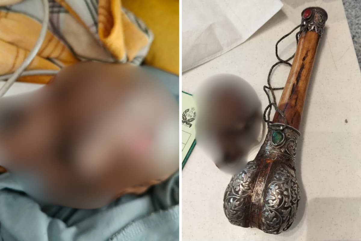 Skull Found Hidden In Passenger’s Hand Baggage At Delhi Airport, CISF Intercepts Flyer