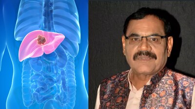 Cancer recurrence means that cancer has returned after a period when it could no longer be detected or after treatment.