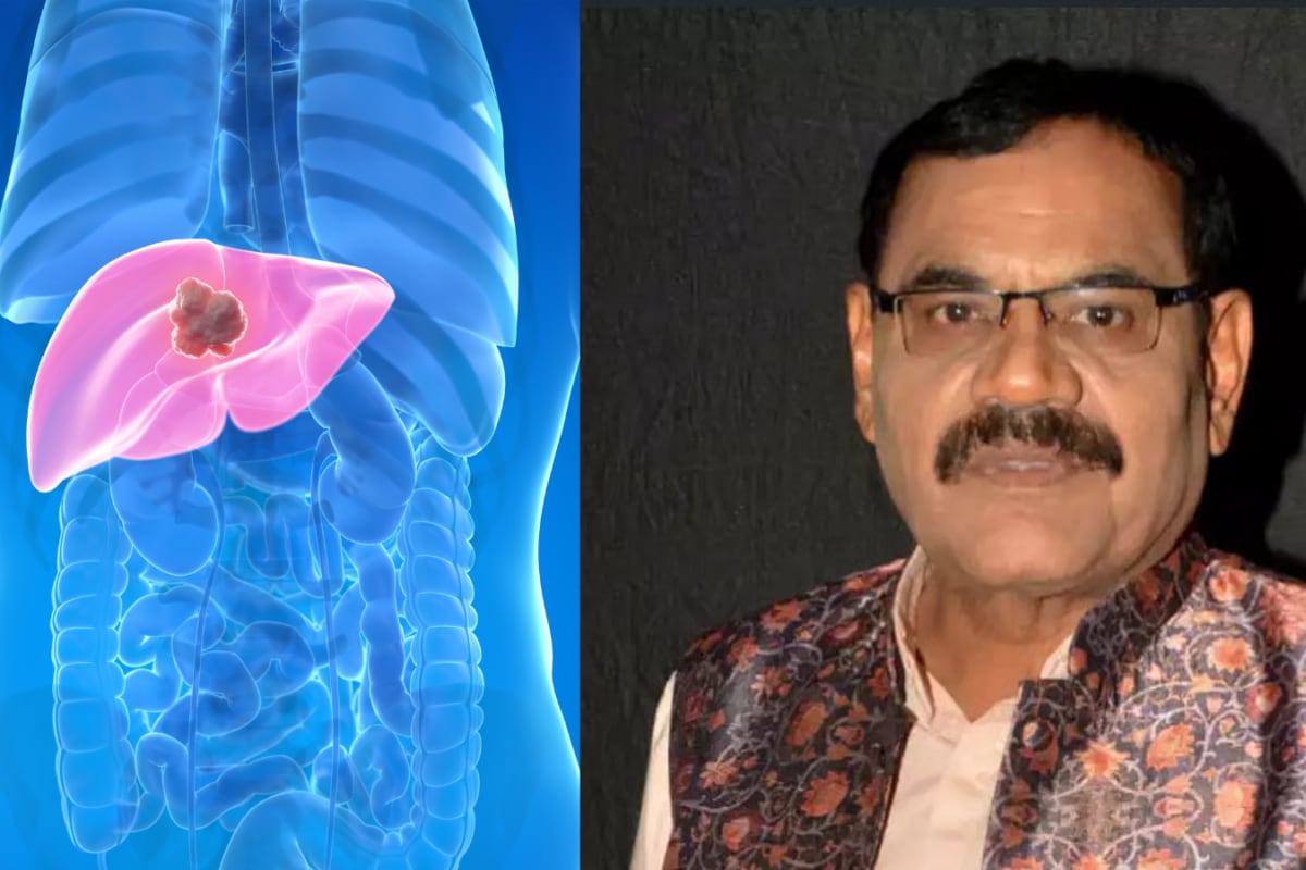 Mushtaq Khan Dies At 56 After Battle With Cancer: What Happens When Cancer Relapses In The Body?c