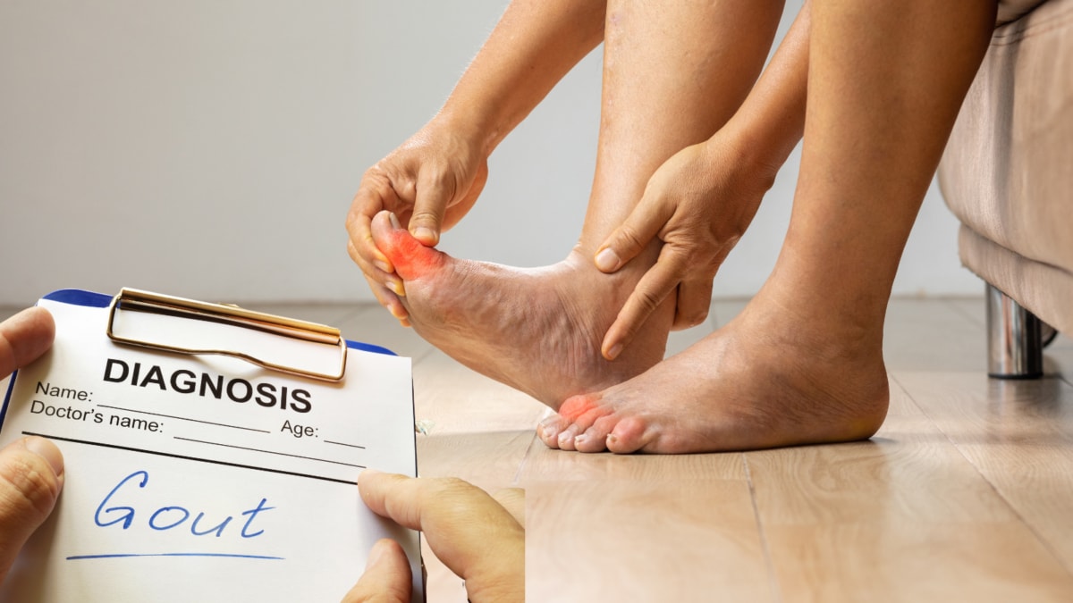 China’s Rare-Earth Cerium Drug Targets The Root Causes Of Gout: Scientists Reveal How It Works