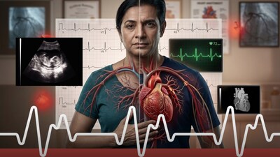 Cardiovascular disease remains the leading cause of death globally, accounting for an estimated 19.8 million deaths in 2022, according to the World Health Organization.