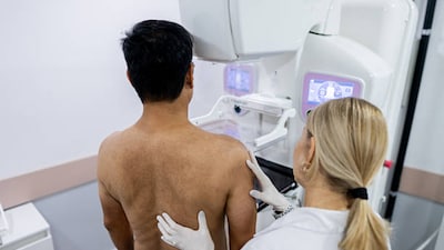 Breast cancer in men is uncommon, roughly one in every hundred cases but that rarity itself becomes a problem. 