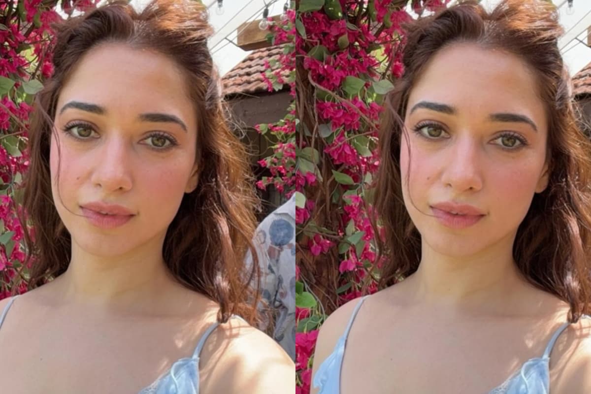 Pimple? So What! Tamannaah Bhatia’s ‘No Filter’ Mantra Is The Skin-Day Reality Check We Needed