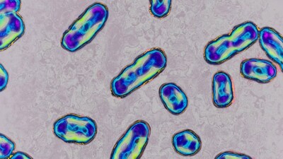 Based on what is currently known, there is no evidence that the Russian case represents a new COVID-like pandemic.