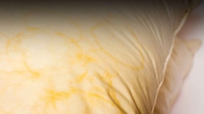 Yellow Pillow Stains? This Simple Trick Makes Them Look New! (Image: File Photo)