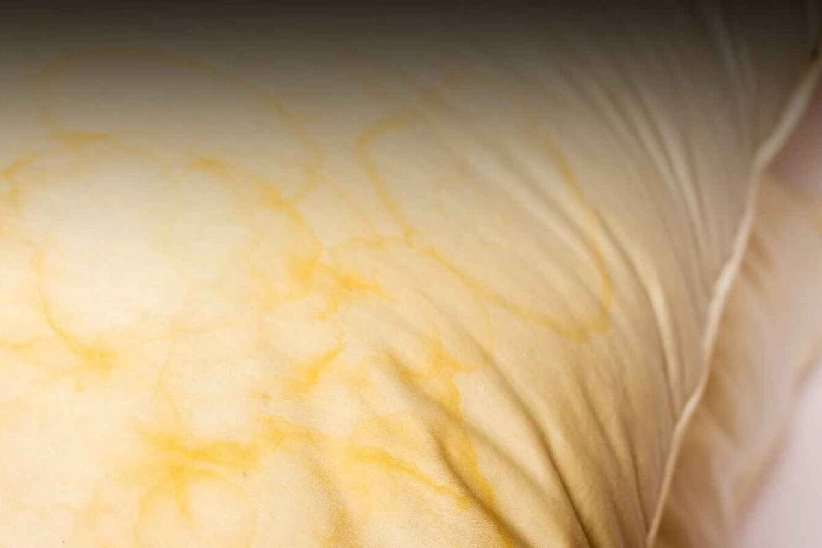 Why Do Pillows Turn Yellow? Easy Ways To Remove Stains And Keep Them Fresh