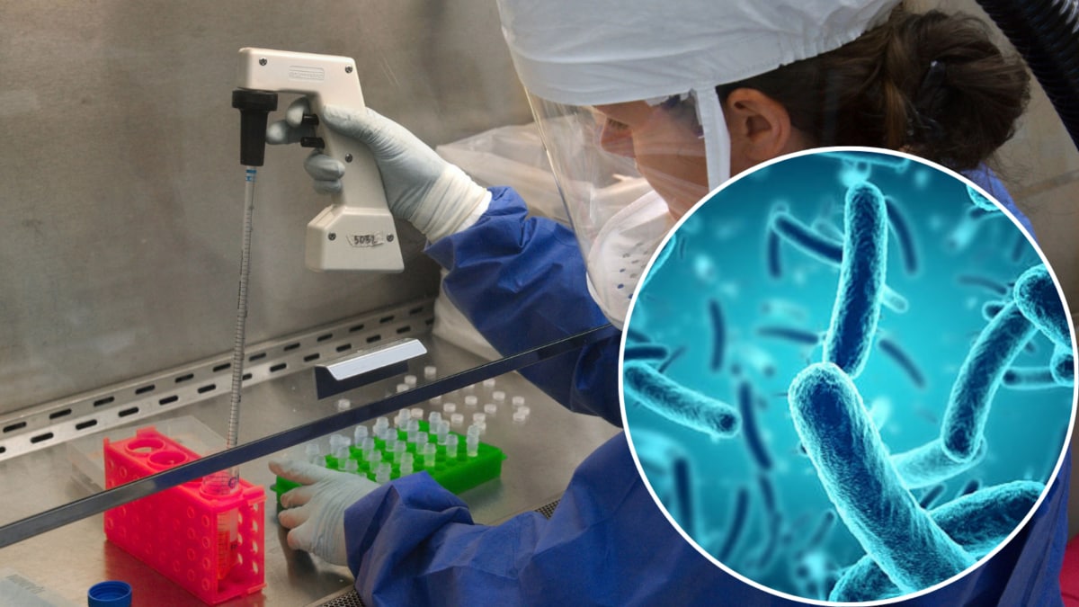 WHO Says Siberia Plague Risk Is Low After Lab Worker’s Death