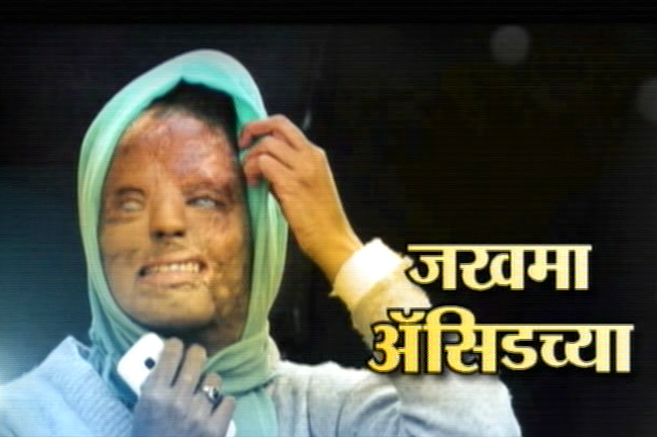 रिपोर्ताज : जखमा अॅसिडच्या