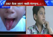 उत्तर दिलं नाही म्हणून विद्यार्थ्याच्या जिभेला चटके