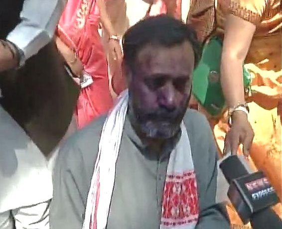 योगेंद्र यादव यांच्या चेहर्यावर फेकली शाई