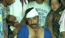 मनसे उमेदवार संजय तुरडेंवर प्राणघातक हल्ला