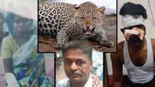 मुलुंडमध्ये बिबट्याचा तिघांवर हल्ला, खा. सोमय्यांचा जखमीसोबत सेल्फी ! मुलुंडमध्ये बिबट्याचा तिघांवर हल्ला, खा. सोमय्यांचा जखमीसोबत सेल्फी !