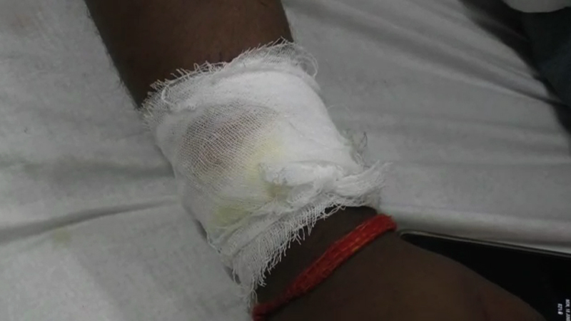 शिवसेना शाखा प्रमुखाकडूनच नगरसेवकावर धारधार शस्त्राने हल्ला