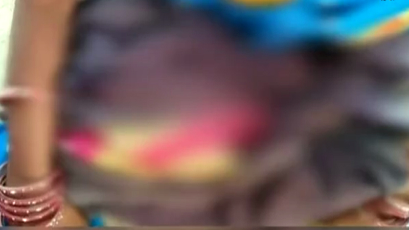 क्रुरता!,महिलेला बेदम मारहाणीत गर्भातल्या अर्भकाचा मृत्यू