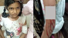 डोंबिवलीच्या पलावसिटीत चिमुरडीवर भटक्या कुत्र्यांचा हल्ला डोंबिवलीच्या पलावसिटीत चिमुरडीवर भटक्या कुत्र्यांचा हल्ला