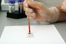 निरोगी राहण्यासाठी 'या' टेस्ट नियमित कराच निरोगी राहण्यासाठी 'या' टेस्ट नियमित कराच