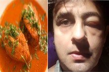 मासे खात असाल तर सावधान! कारण सोनू निगम मरता-मरता वाचला