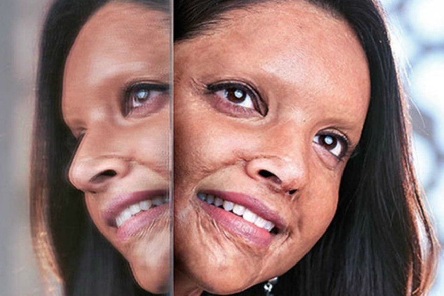 VIDEO: 'लाज वाटली पाहिजे' छपाक लूकवर दीपिकाने दिलं TikTok चॅलेंज