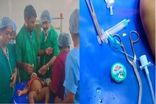 देवासारखे धावून आले डॉक्टर, 6 महिन्याच्या चिमुकल्याच्या गळ्यातून काढली विक्सची डबी