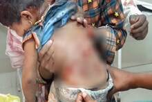 धक्कादायक! 5 कुत्र्यांचा 1 चिमुरड्यावर क्रूर हल्ला