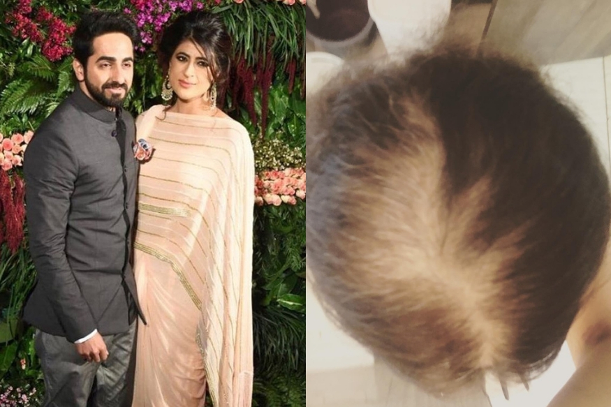 कर्करोगामुळे अशी झाली होती आयुष्मान खुरानाच्या बायकोची अवस्था