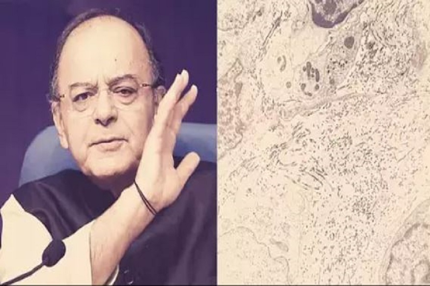 काय आहे Soft tissue sarcoma ज्याच्याशी अरुण जेटलींची झुंज अपयशी ठरली?