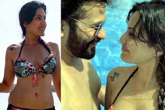 टीव्ही अभिनेत्रीनं बिकिनी फोटोमध्ये दाखवले शरीरावरील व्रण, म्हणाली...
