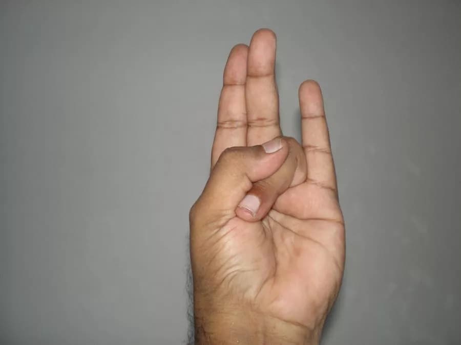 अनामिकेला हाताजवळ दुमडून आंगठ्याने दाबा. उरलेली तीन बोटं सरळ ठेवा. याला सूर्य मुद्रा असं म्हणतात. या मुद्रेत दररोज 5 ते 15 मिनिटं बसा. यामुळे कोलेस्ट्रॉल कमी होतं. अनामिकेला हाताजवळ दुमडून आंगठ्याने दाबा. उरलेली तीन बोटं सरळ ठेवा. याला सूर्य मुद्रा असं म्हणतात. या मुद्रेत दररोज 5 ते 15 मिनिटं बसा. यामुळे कोलेस्ट्रॉल कमी होतं.